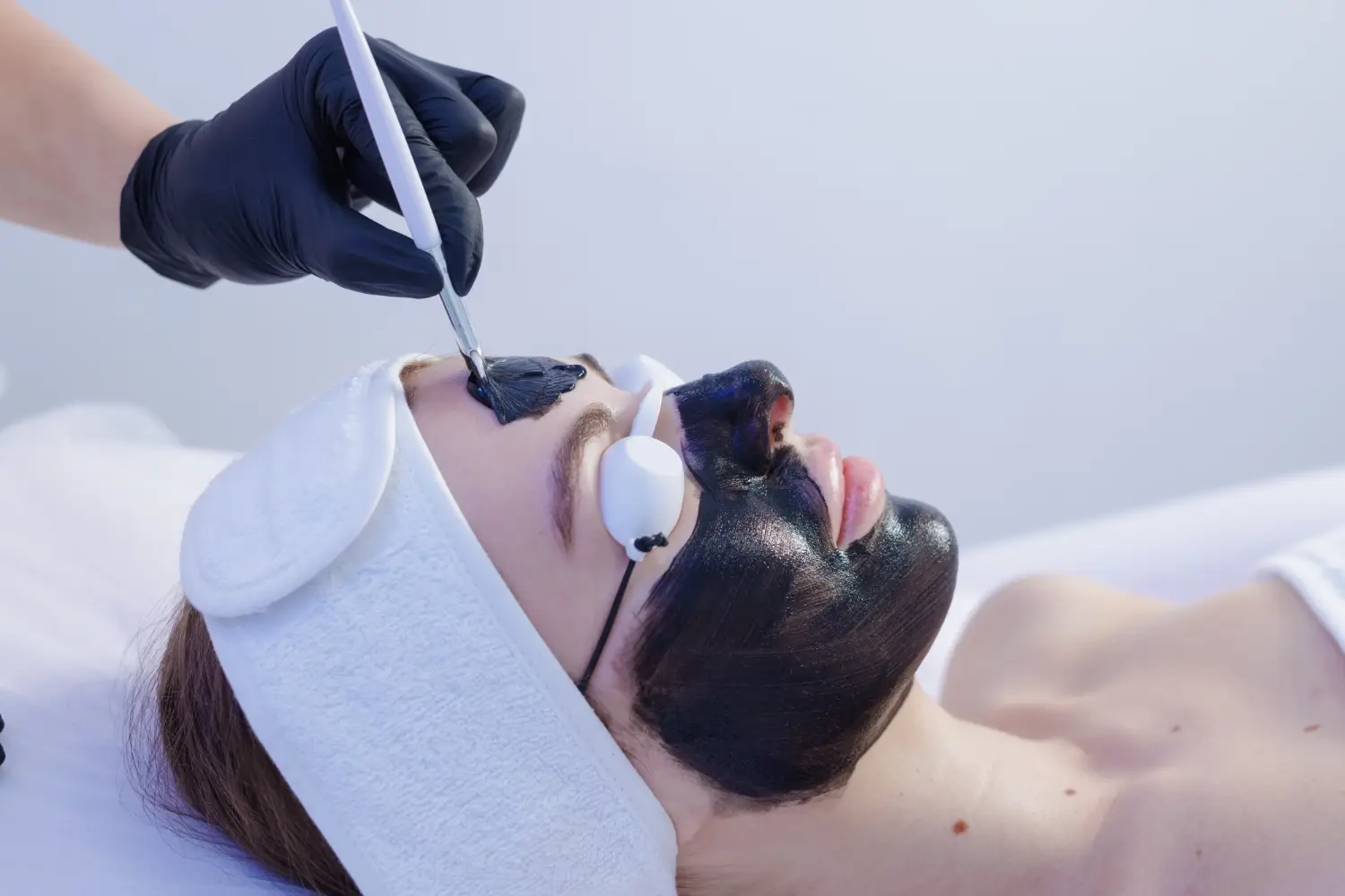 Practitioner applying a black facial mask to a client wearing protective eye shields.
