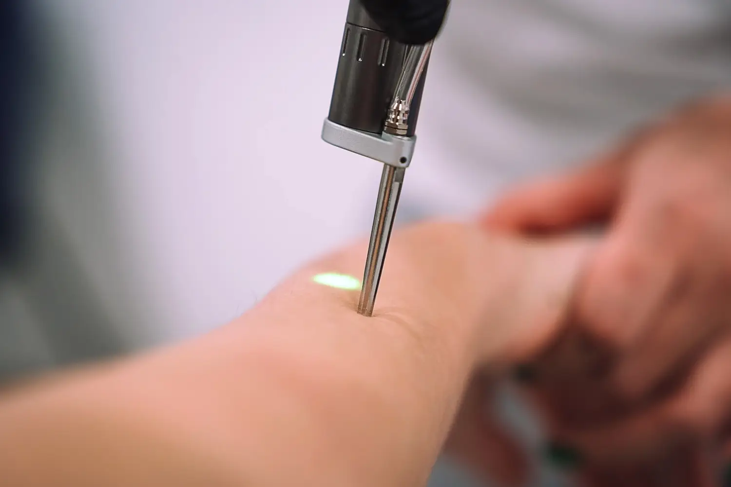 Close-up of a precision laser device being applied to a client’s arm.